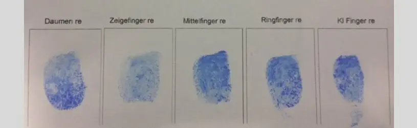 Vergleich von Fingerbadrücken.