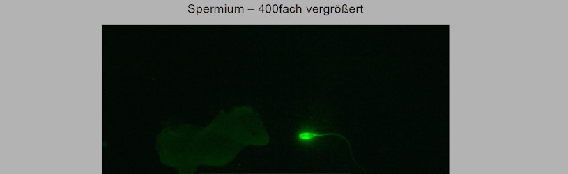 Mikroskopische Prüfung bei einer Laboruntersuchung.