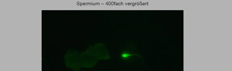 Mikroskopische Prüfung bei einer Laboruntersuchung.