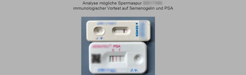 Immunologischer Vortest auf Semenogelin und PSA