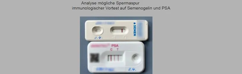 Immunologischer Vortest auf Semenogelin und PSA